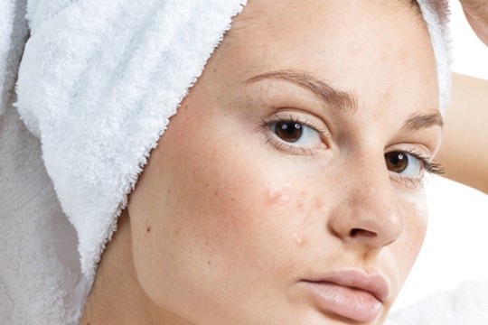 image-comparison-1 image-comparison-1